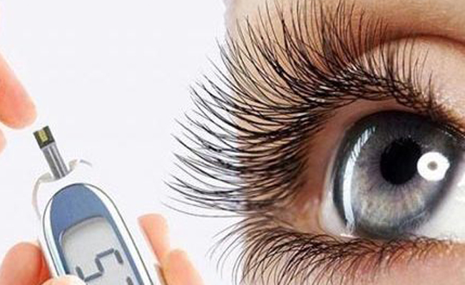 Şeker hastalarının göz tedavisi